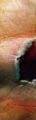 This is a shot of the wound on my hand where I fell. I messed with the colors. It's kind of hard to get it to heal.